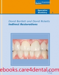 Indirect Restorations (PDF+EPUB)